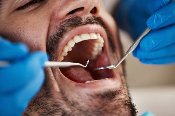 Best Emergency Denture Repair in Culpeper, VA